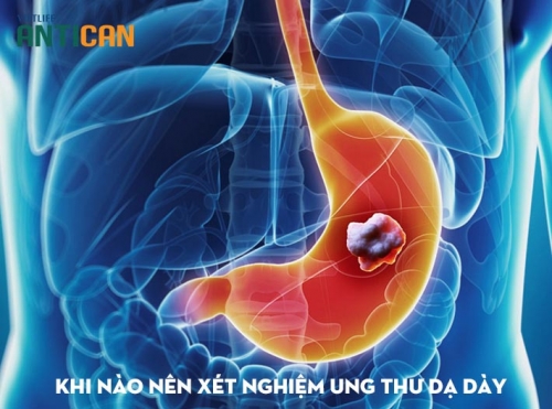 7 xét nghiệm ung thư dạ dày phổ biến nhất hiện nay