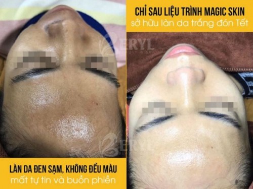 6 spa chăm sóc da mặt tốt nhất tại quận bình thạnh, tp. hcm