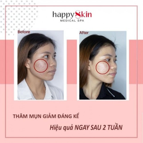 6 spa chăm sóc da mặt tốt nhất tại quận bình thạnh, tp. hcm