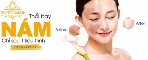 7 spa trị nám tốt nhất tp. vinh, nghệ an