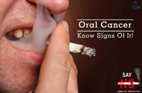 8 điều cần biết nhất về căn bệnh ung thư khoang miệng