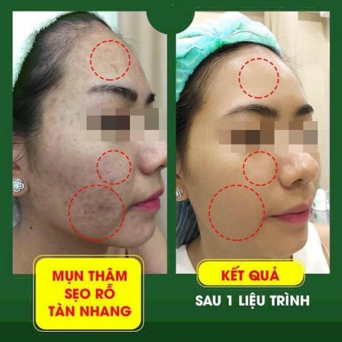 5 thẩm mỹ viện uy tín và chất lượng nhất bắc giang