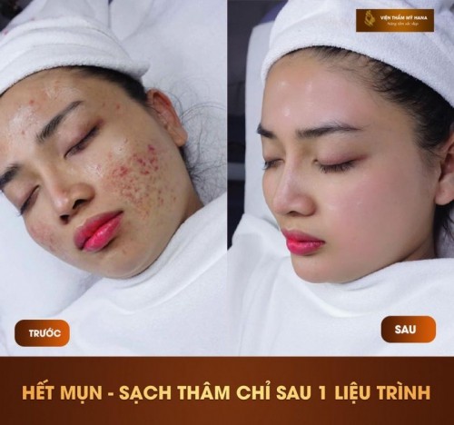 5 thẩm mỹ viện uy tín và chất lượng nhất bắc giang