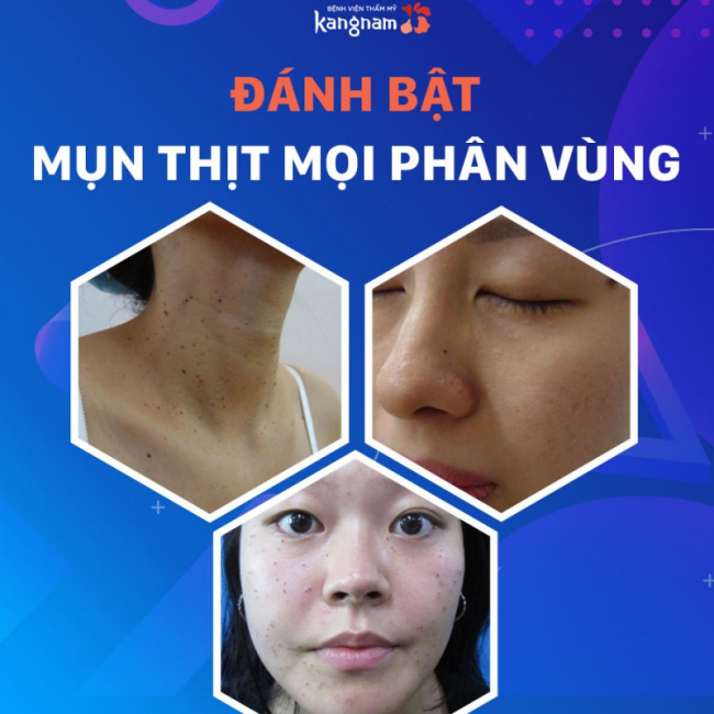 11 thẩm mỹ viện uy tín và chất lượng nhất quận 3, tp. hcm