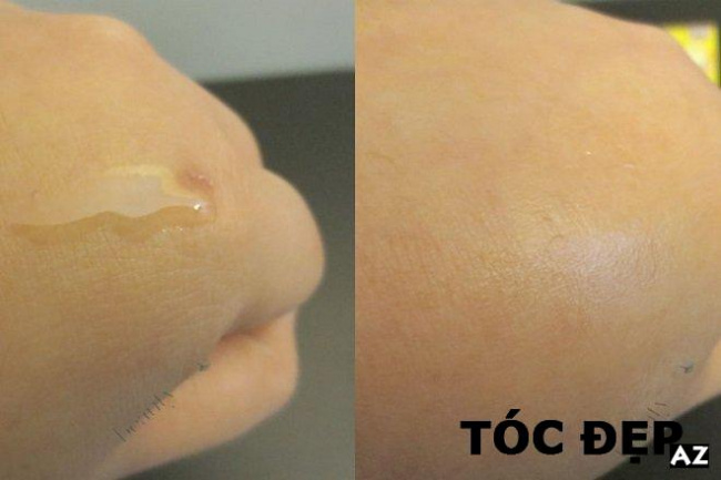 blog, [review] serum cc melano trị mụn thâm – review công dụng, cách dùng, giá bán