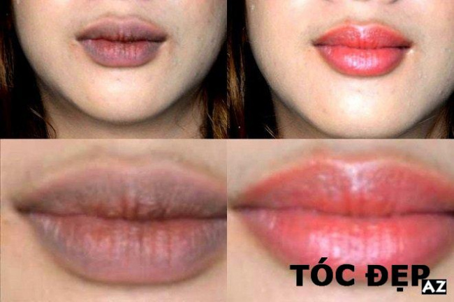blog, [review] cách trị thâm môi bằng kem đánh răng đơn giản mà hiệu quả tại nhà