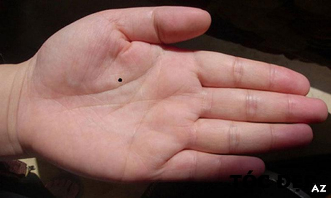 [Review] Nốt ruồi ở tay: Ý nghĩa của từng vị trí và có nên tẩy hay không?