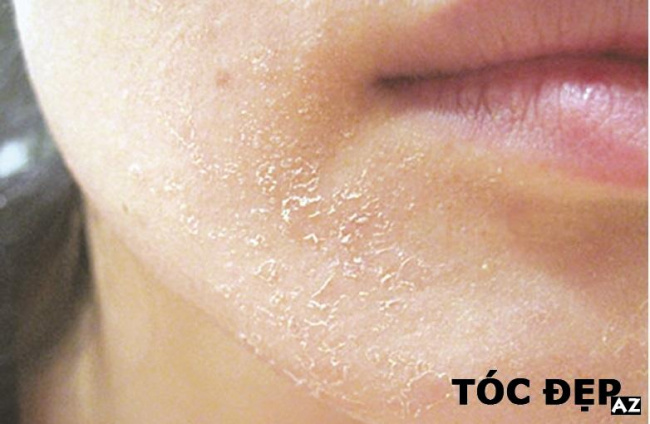[Review] Da mặt khô nên dùng gì cấp ẩm để hỗ trợ tái tạo da
