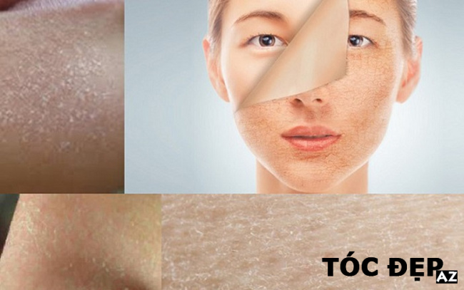 blog, [review] da khô là gì? nguyên nhân và cách chăm sóc da khô 