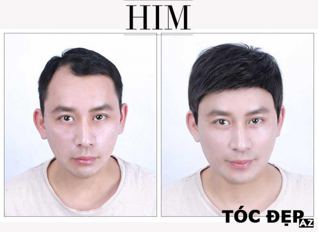 Review Top 5 địa chỉ mua tóc giả nam ở Hà Nội  ALONGWALKER