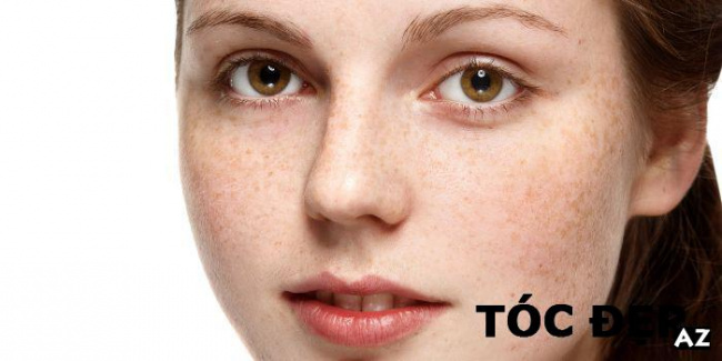[Review] Nguyên nhân và cách khắc phục tình trạng da mặt bị đỏ và nóng
