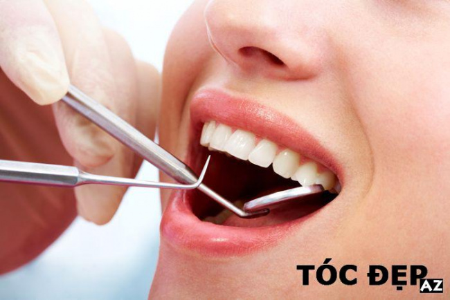 Tác hại của tẩy trắng răng bạn nên biết trước khi làm