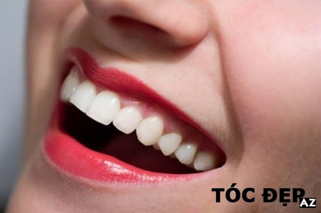 blog, tác hại của tẩy trắng răng bạn nên biết trước khi làm