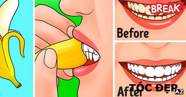 blog, 2 cách lấy cao răng bằng vỏ chuối dễ làm như ăn kẹo
