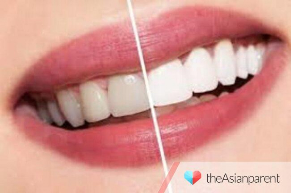 Những cách làm trắng răng tại nhà từ nguyên liệu thiên nhiên đơn giản mà hiệu quả