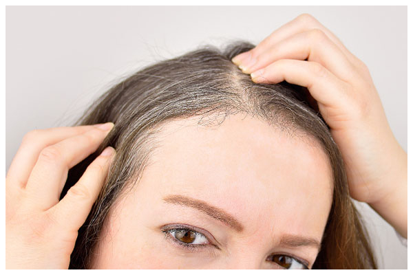 Giải pháp ngăn chặn tình trạng tóc bạc sớm ở nữ giới