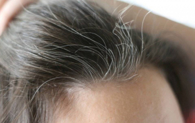 giải pháp ngăn chặn tình trạng tóc bạc sớm ở nữ giới