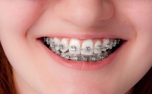 5 nha khoa trồng răng implant tốt uy tín tại tp. biên hòa, đồng nai