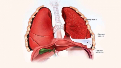 10 lưu ý quan trọng nhất về bệnh lupus ban đỏ