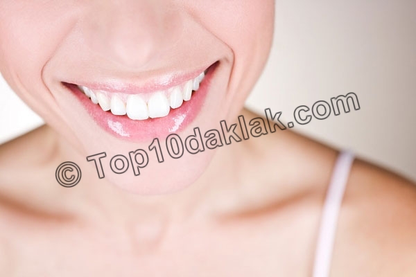 Top 10 cách làm trắng răng hiệu quả nhanh nhất trong 1 tuần