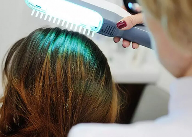 Tìm hiểu về phương pháp điều trị rụng tóc bằng laser