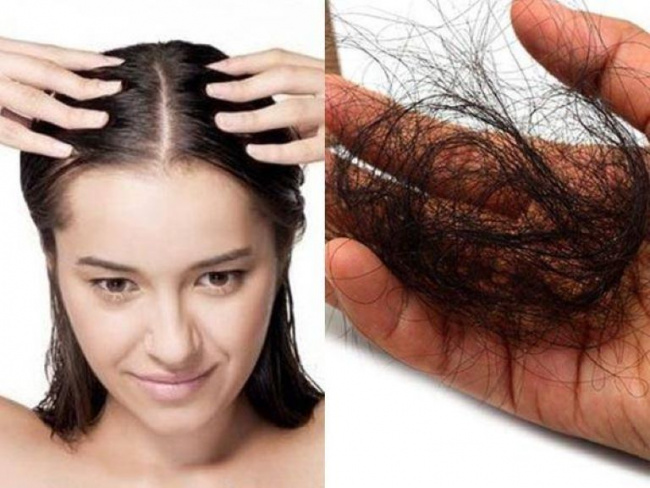 trị rụng tóc, kích thích mọc tóc, 5 cách kích thích mọc tóc tự nhiên hiệu quả