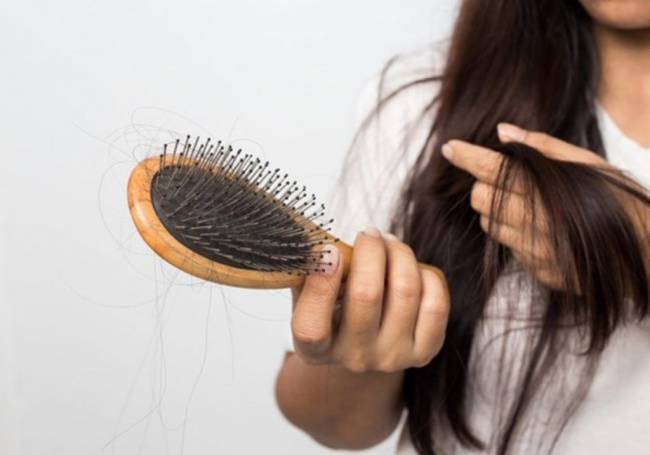 trị tóc rụng, biện pháp khắc phục tình trạng tóc rụng hiệu quả