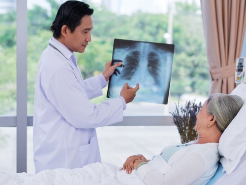 9 lưu ý quan trọng nhất về bệnh viêm màng phổi
