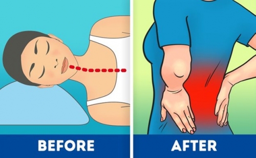 7 Nguyên nhân gây đau thắt lưng và cách phòng tránh