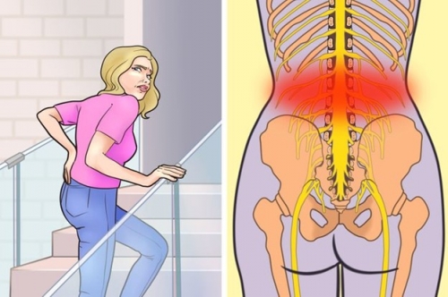 7 nguyên nhân gây đau thắt lưng và cách phòng tránh