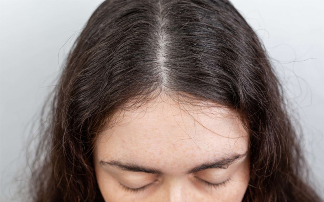 Gợi ý những cách làm mềm tóc rễ tre hiệu quả 100% sau khi thực hiện