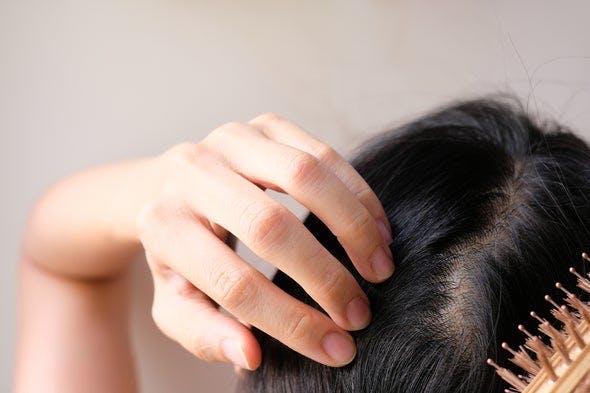 giảm cân gây rụng tóc: làm thế nào khắc phục tình trạng này?
