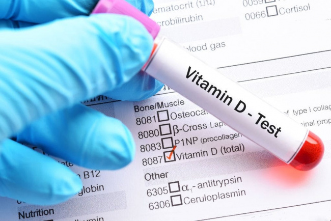5 lợi ích sức khỏe của vitamin d