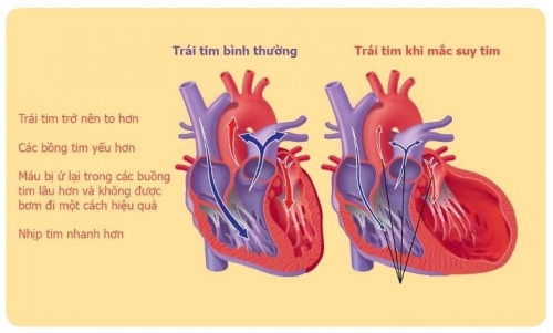 10 bệnh lý tim mạch phổ biến nhất mà bạn nên biết