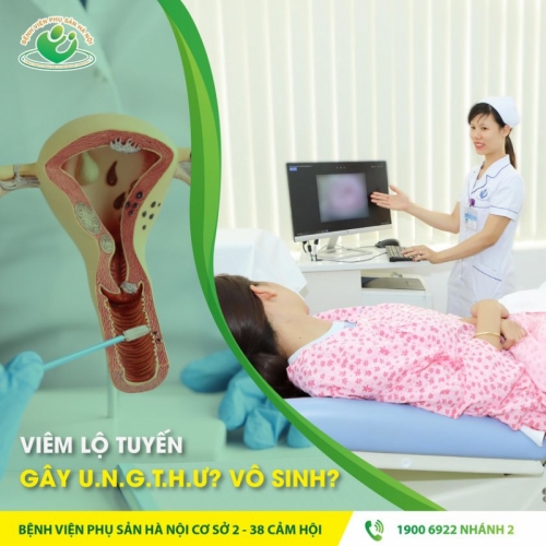 7 địa chỉ khám và điều trị viêm lộ tuyến cổ tử cung uy tín nhất hà nội