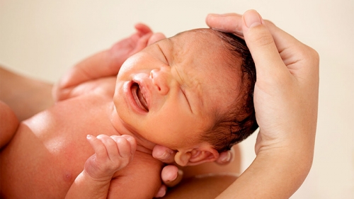 7 điều cần biết về bệnh vàng da sơ sinh