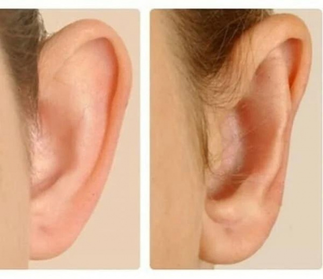 vành tai, tướng tai, vành tai lớn, người có tai mỏng, nhìn hình dáng tai biết ngay cuộc đời phú quý hay bần hèn