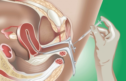 8 địa chỉ thụ tinh nhân tạo (iui) uy tín nhất hà nội