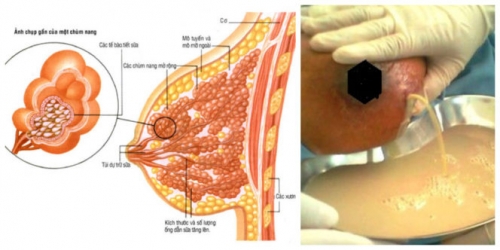 8 địa chỉ thụ tinh nhân tạo (iui) uy tín nhất hà nội