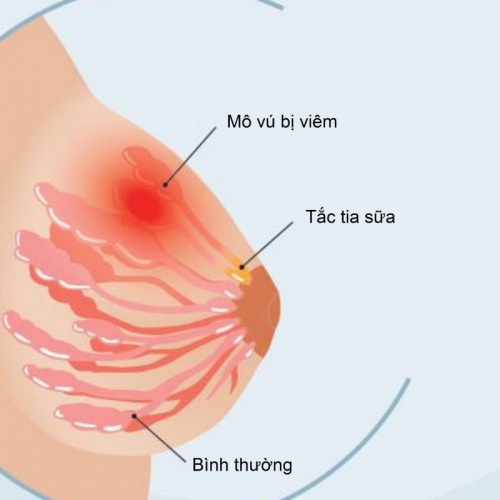 8 địa chỉ thụ tinh nhân tạo (iui) uy tín nhất hà nội