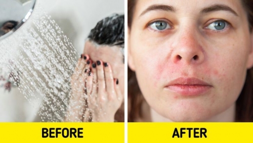 5 tác hại của việc rửa mặt bằng vòi hoa sen khi tắm