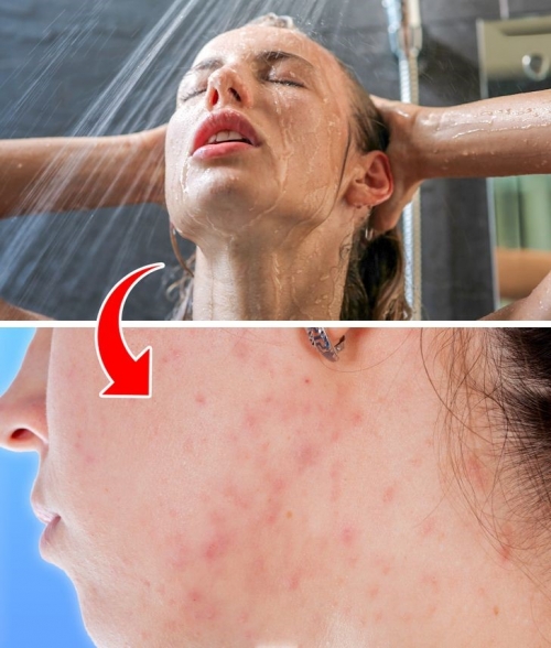 5 tác hại của việc rửa mặt bằng vòi hoa sen khi tắm