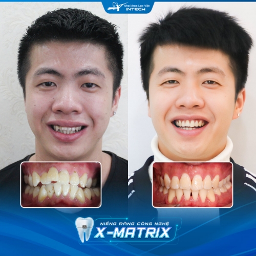 8 Phòng khám răng hàm mặt uy tín nhất tại TP. Vinh, Nghệ An
