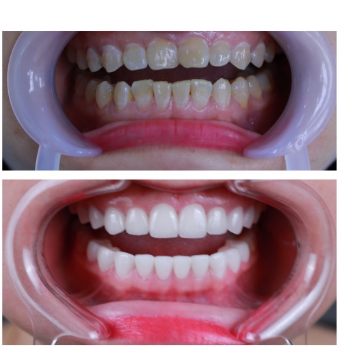 8 phòng khám răng hàm mặt uy tín nhất tại tp. vinh, nghệ an