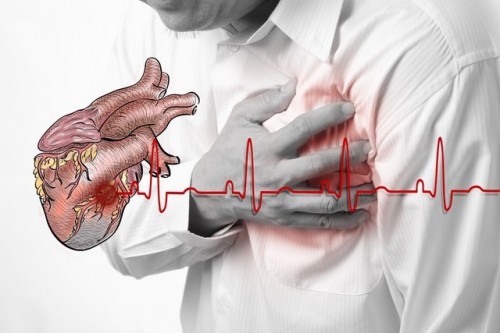 8 bệnh tim mạch thường gặp nhất