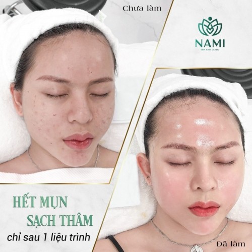 10 spa uy tín nhất và chất lượng nhất tại hải phòng