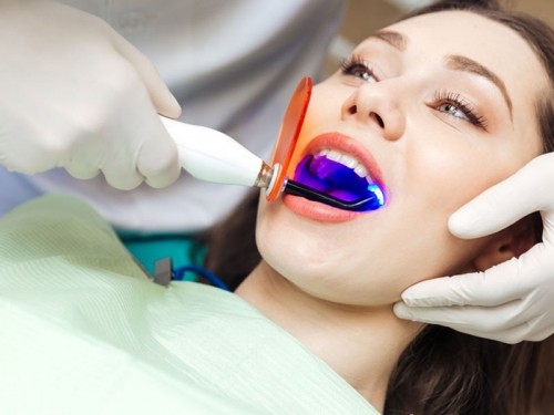 7 điều cần biết khi tẩy trắng răng