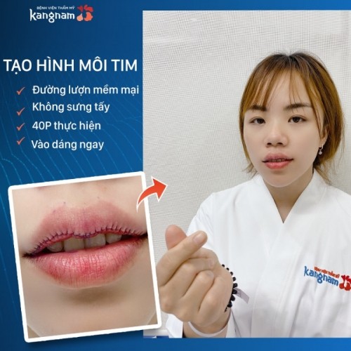 10 địa chỉ tạo môi trái tim đẹp và chất lượng nhất hà nội