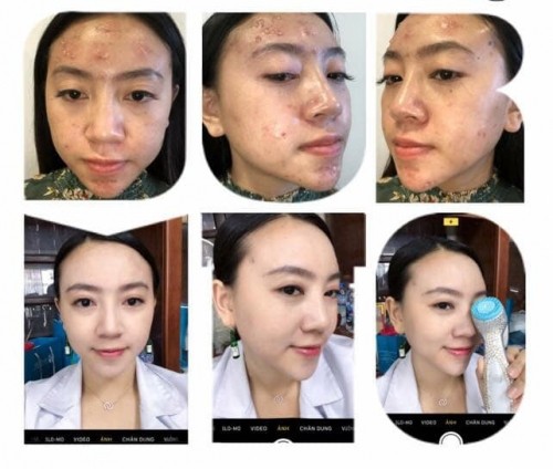 10 spa chăm sóc da mặt tốt nhất đà lạt, bạn nên trải nghiệm
