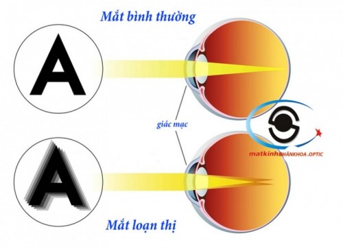 7 bệnh thường gặp về mắt và phương pháp điều trị hiệu quả